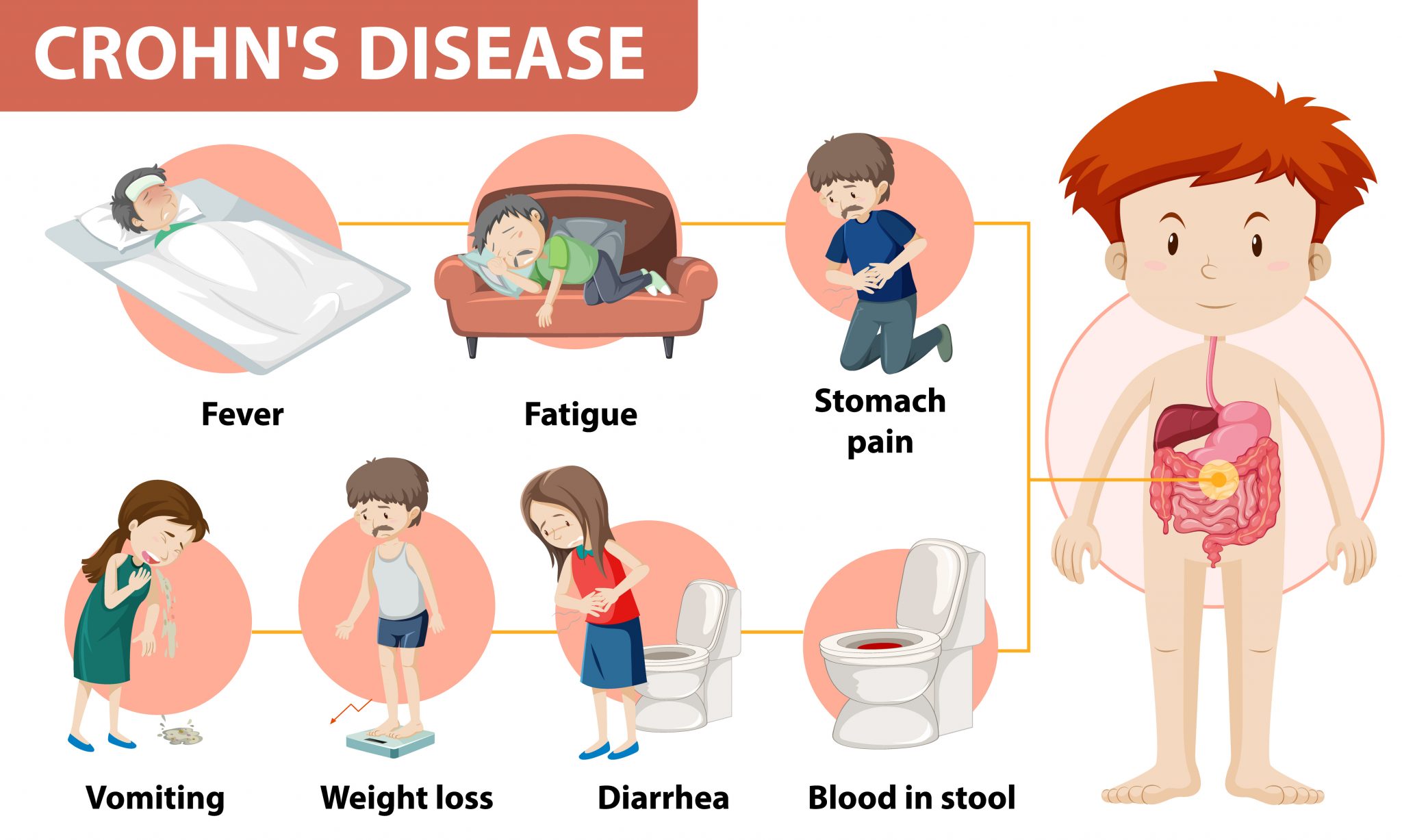 Tips To Manage Crohn's Disease And Colitis Fatigue - Reach Out Recovery