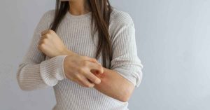 What is eczema