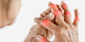 Joint Pain Relieve