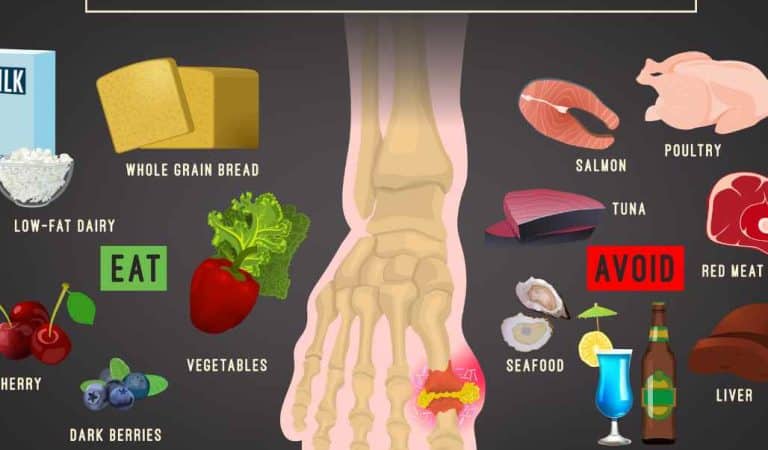 Weight Loss Strategies For Gout
