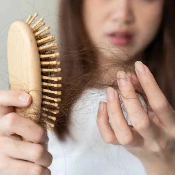 hair loss and stress